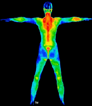 thermography